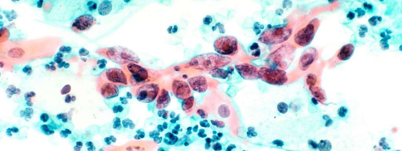 Welcome to RPS Cancer Lab