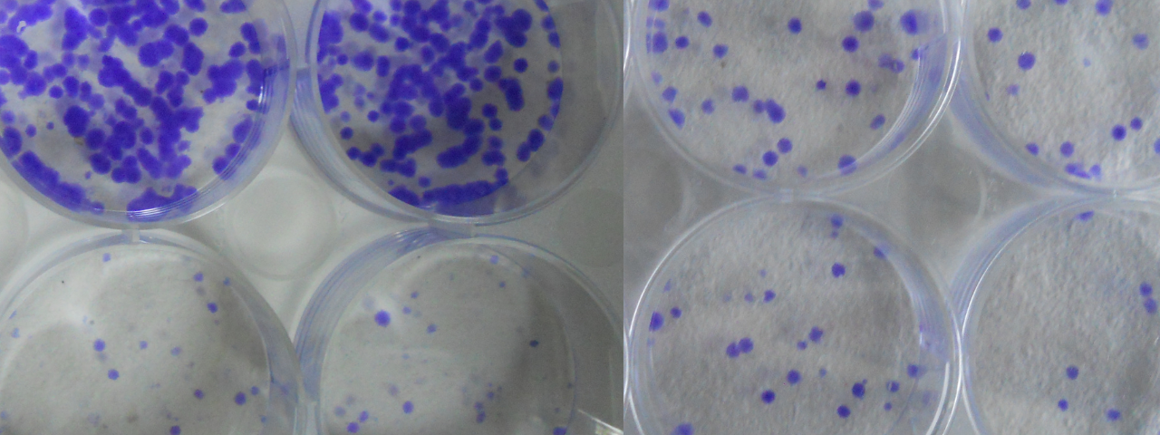 Welcome to RPS Cancer Lab